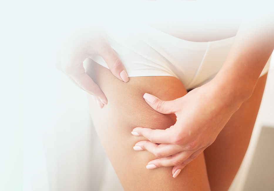 Scars, Cellulite & Stretch Marks Scars, Cellulite & Stretch Marks