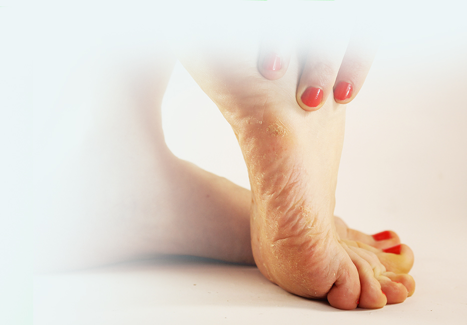 Fungal Infections Fungal Infections